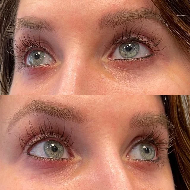 Dr. Lara Devgan Platinum Long Lash Review: A Dermatologist-Backed Approach to Fuller Lashes